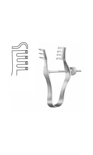 Wound Spreaders
